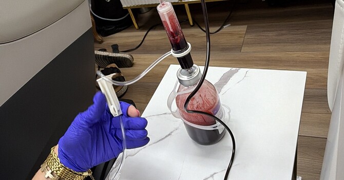 Ozone Therapy